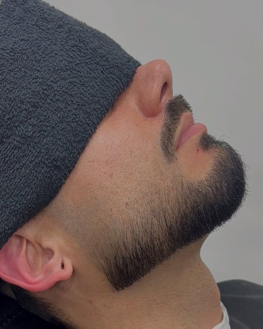 Light Stubble Fade