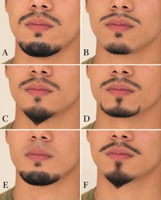 Six Chin Shapes Compared
